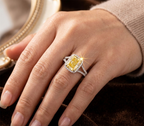 Ring Wear On Finger 